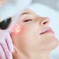 How Sleep Therapy Complements Laser Skin Rejuvenation in Woodland Hills, CA
