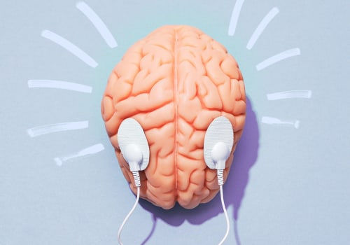CBT-I: A Comprehensive Guide to Treating Insomnia